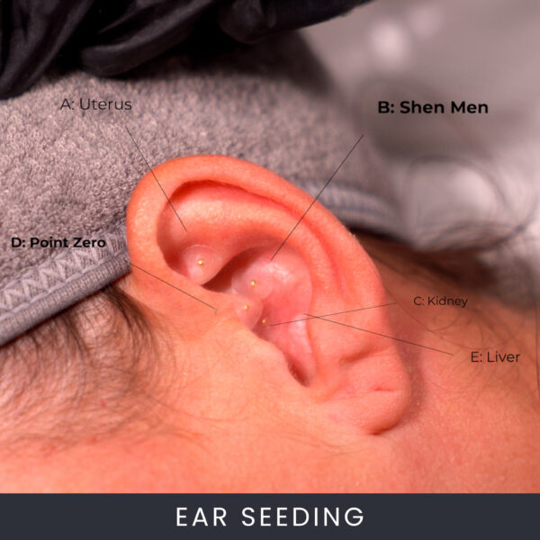 Ear Seeding Course Online