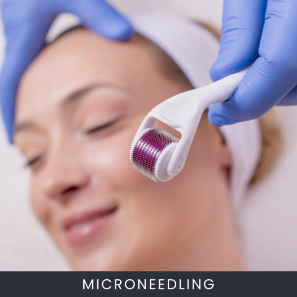Microneedling Microneedling Course Online