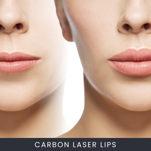 Carbon Laser Lip Plumping Course Online