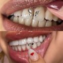 Tooth Gem Course Online